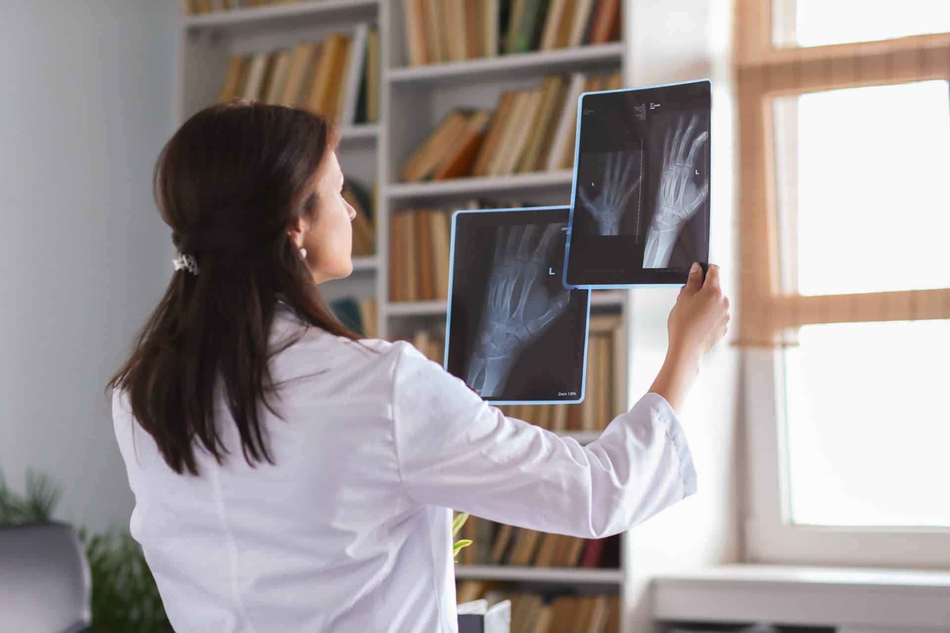 Medico esamina lastre radiografiche